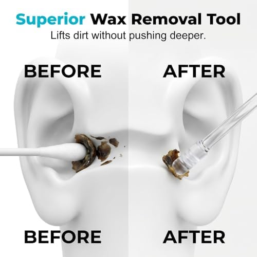Sticky Ear Cleaning Stick, Reusable Ear Cleaning Tool (1 Set/24 PCS) | 2026 Upgraded Earwax Removal Adhesive Swabs, GentleEar Wax Removal Tools for Adults, Home